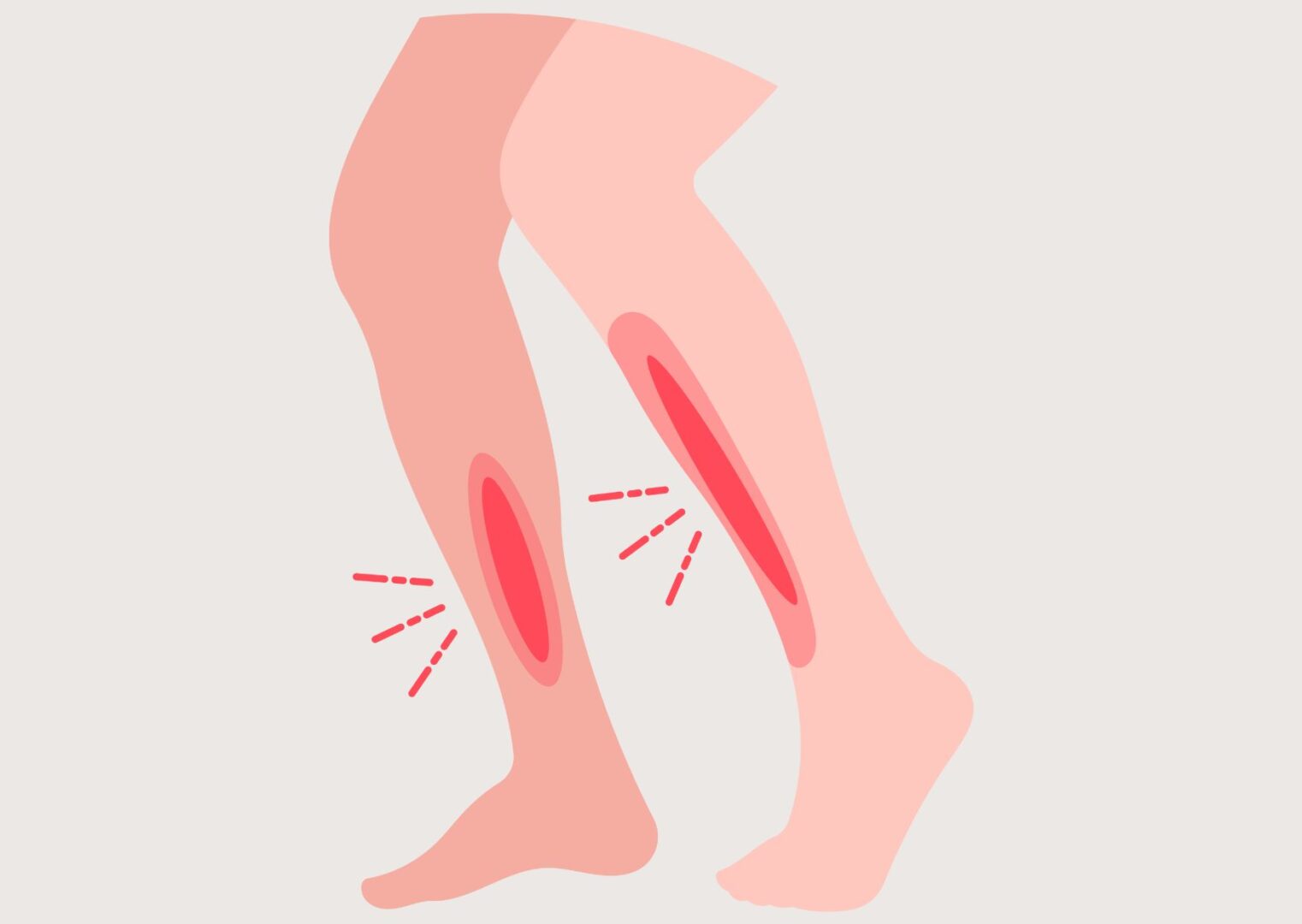 alt="Hardloper met pijn aan schenen door shin splints"